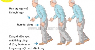 Bệnh Parkinson là gì? Nguyên nhân, dấu hiệu và chẩn đoán bệnh